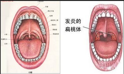 巢ǰԱͼ